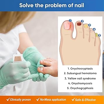 FungalFix™ - Fungal Nail Renewal Patches