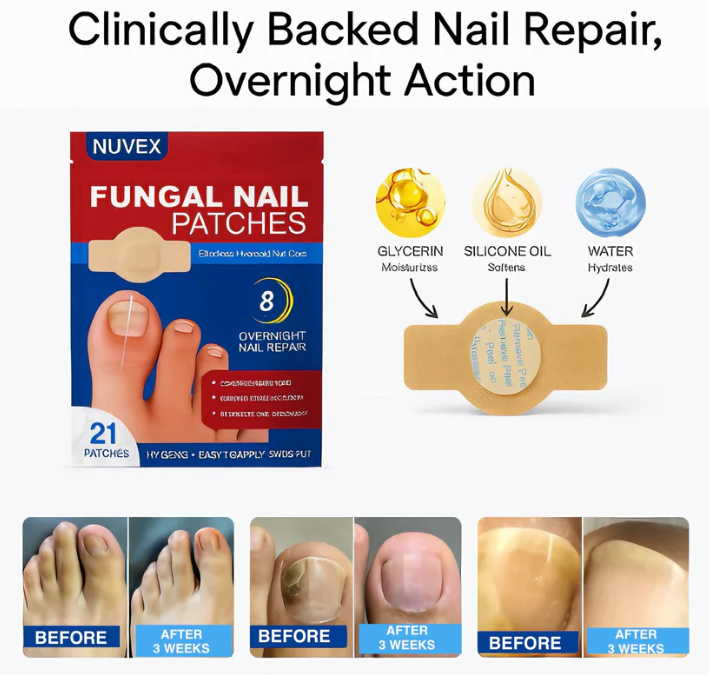 FungalFix™ - Fungal Nail Renewal Patches