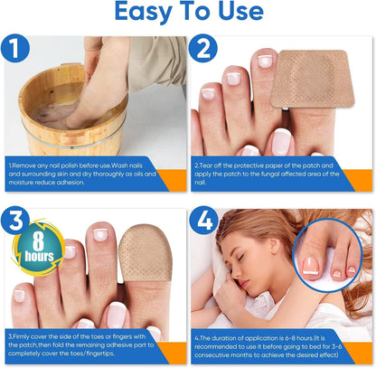 FungalFix™ - Fungal Nail Renewal Patches