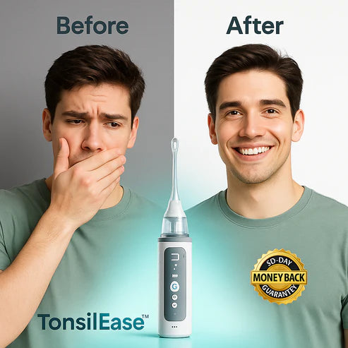 TonsilEase™ - Tonsil Stone Removal Kit