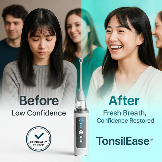 TonsilEase™ - Tonsil Stone Removal Kit