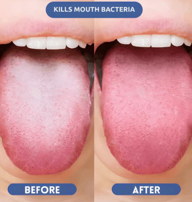 Probiotic CELIKE - Fresh Breath Spray
